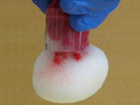 Учёные изобрели спрей-пену, которая мгновенно останавливает кровотечение