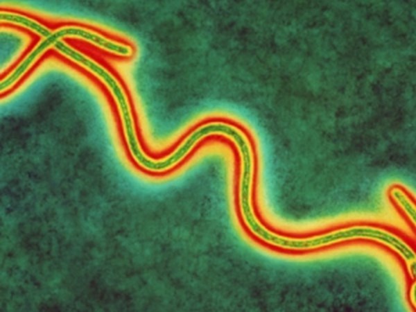 СМИ: СССР планировал сделать вирус Эбола биологическим оружием