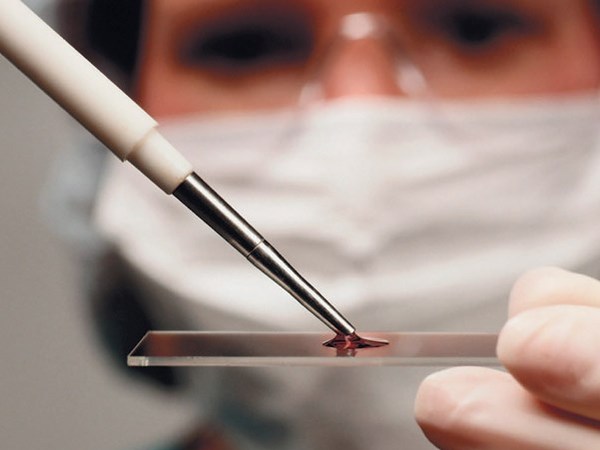 Японские ученые научились определять рак по капле крови