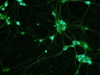 Разработан новый способ точечной доставки стволовых клеток в пораженные места организма