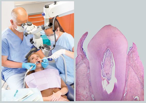 Стоматология будущего: в сети клиник «32 Дент» открыто ультрасовременное лечение зубов под микроскопом